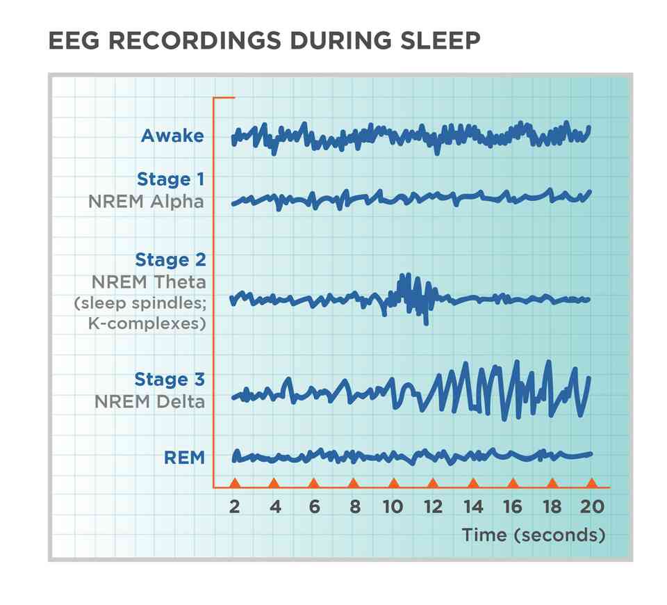 Caffeine and Sleep Architecture: How Your REM Disappears